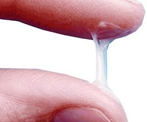 Wie sieht das Sekret eines Mannes normalerweise aus